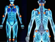  Fibromyalgia? How can I naturally get rid of it? - Natural Treatment